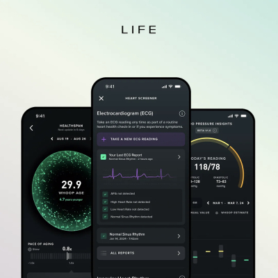 Трекер Whoop Life с подпиской на 1 год (Whoop MG) (Трекер Whoop Чёрный)